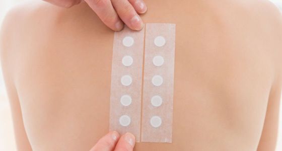 Epikutantest (lappetest)