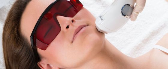 Sprengte blodkar kinn, laser